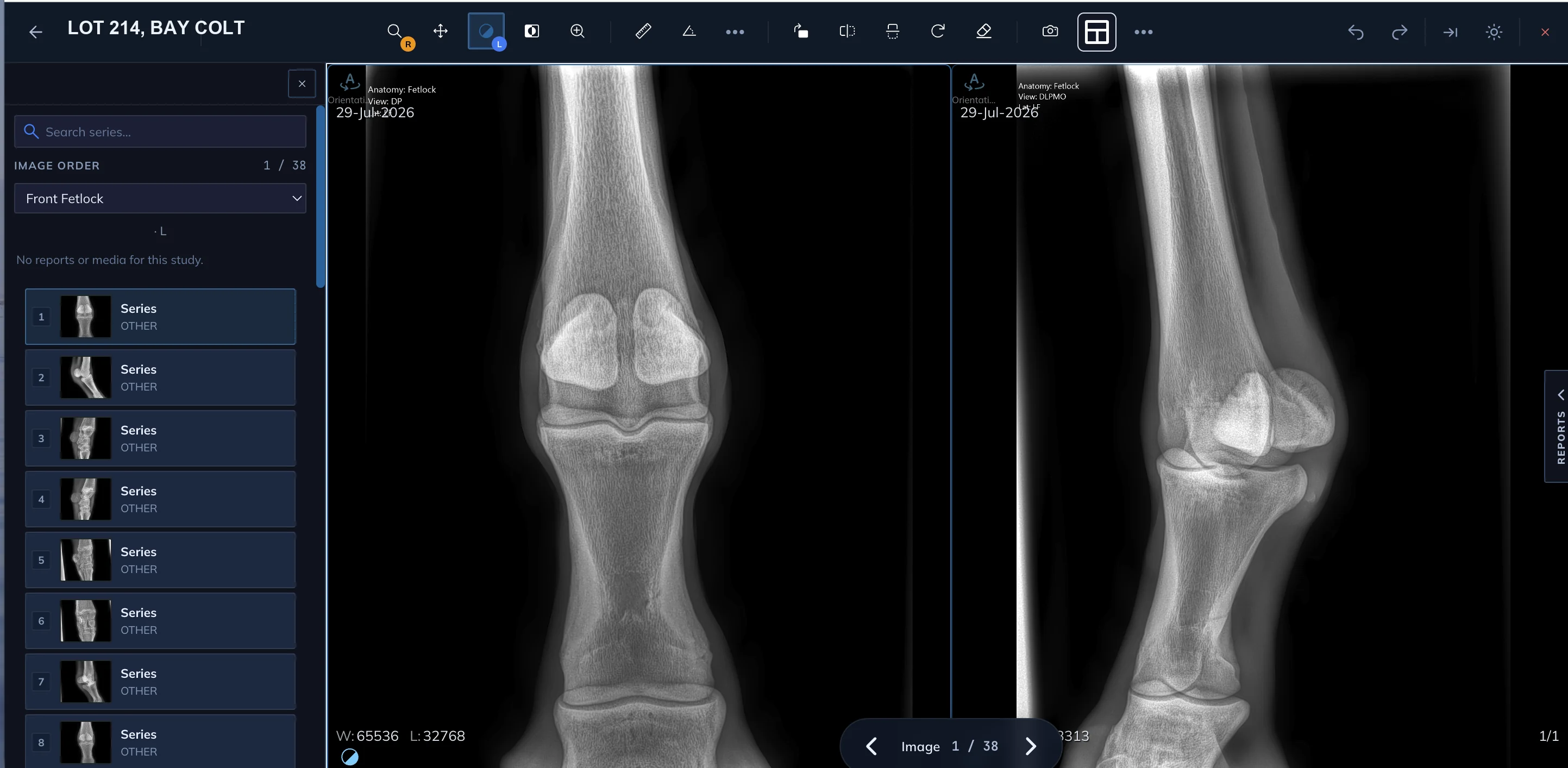 The ThoroughVet V3 viewer: the tool row across the top, the series list with its search, image order and Front Fetlock selector down the left, and two fetlock views side by side, each with its anatomy, view and date